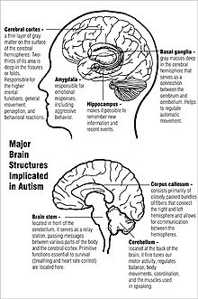 Two diagrams of major brain structures implicated in autism. The upper diagram shows the cerebral cortex near the top and the basal ganglia in the center, just above the amygdala and hippocampus. The lower diagram shows the corpus callosum near the center, the cerebellum in the lower rear, and the brain stem in the lower center.