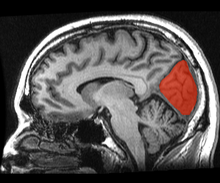Sagittal MRI slice with the cuneus shown in red.