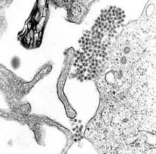 A transmission electron microscopy image showing dengue virus