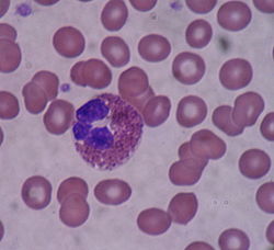 Eosinophil blood smear.JPG