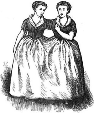 Two women conjoined at the shoulder and waist