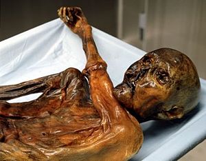 Ötzi the Iceman on a sheet covered autopsy table